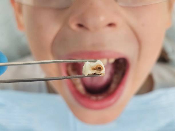 Best Pediatric Emergency Dentist in El Macero, CA